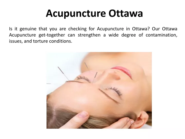 acupuncture ottawa