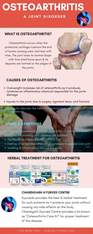 PPT - Knee Osteoarthritis Causes And Common Symptoms - Dr Chirag Patel ...