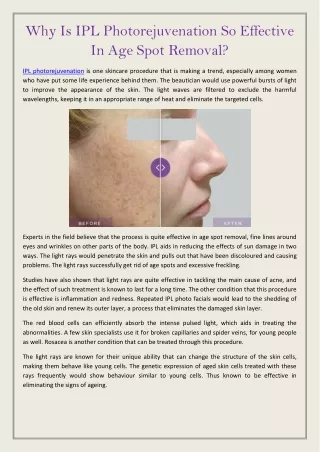 why is ipl photorejuvenation so effective