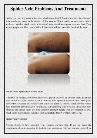 spider vein problems and treatments