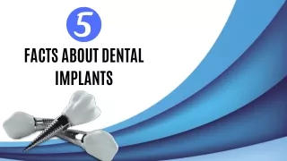 5 Facts About Dental Implants
