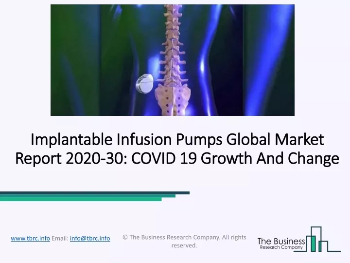implantable infusion pumps global market report 2020 30 covid 19 growth and change
