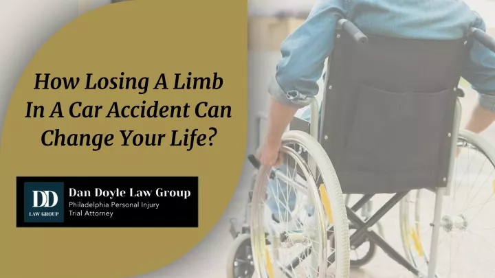 how losing a limb in a car accident can change