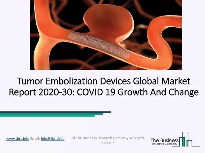 tumor embolization devices global market report 2020 30 covid 19 growth and change
