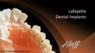 Lafayette Dental Implants