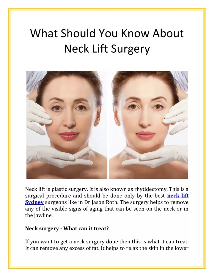 what should you know about neck lift surgery