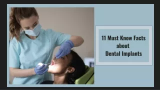 11 Must Know Facts about Dental Implants