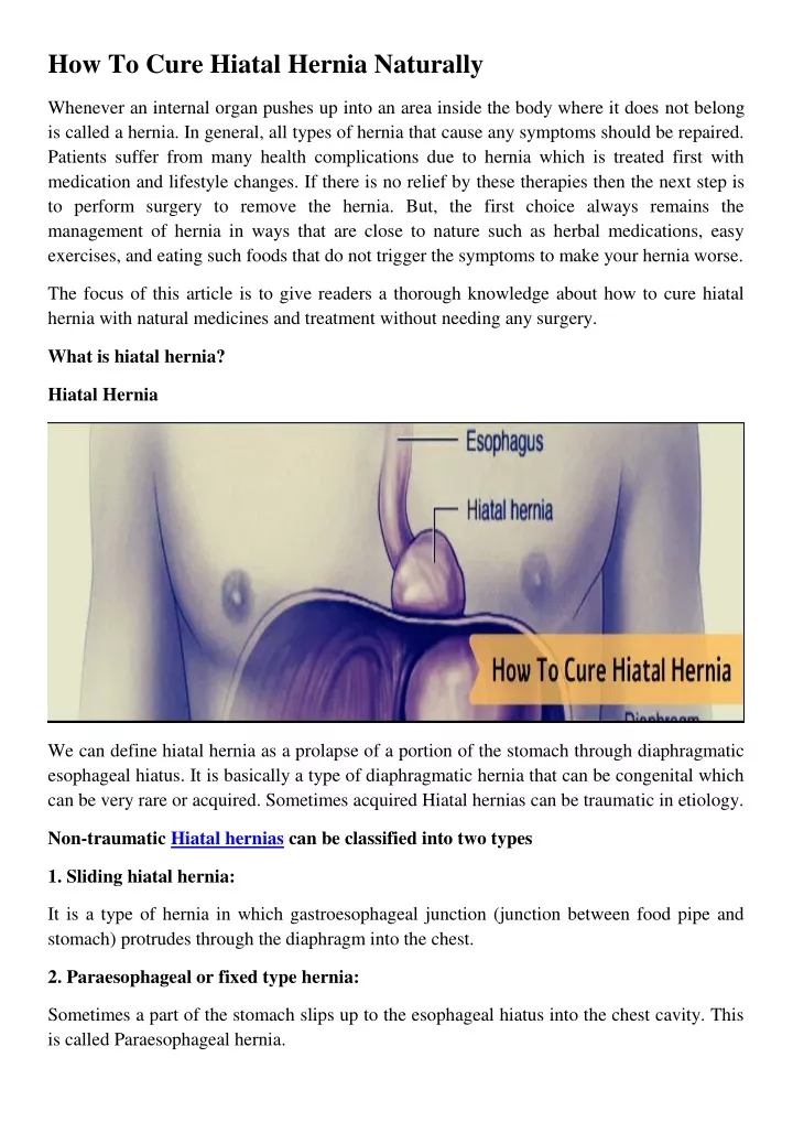 how to cure hiatal hernia naturally