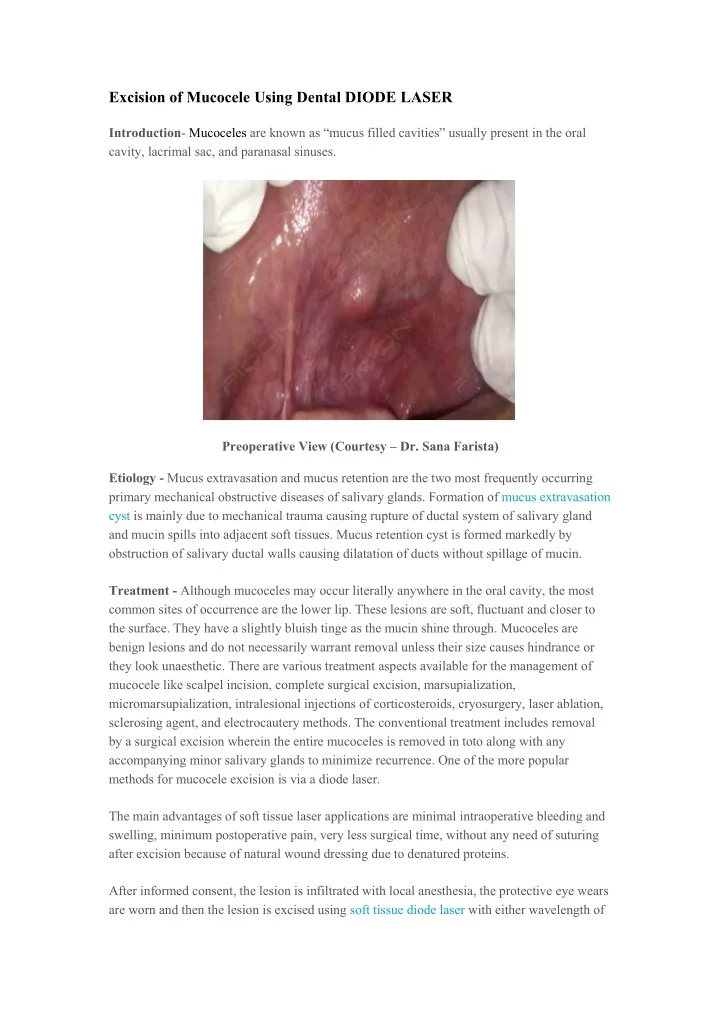 excision of mucocele using dental diode laser