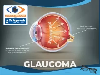 Glaucoma | Glaucoma Surgery, Glaucoma Eye Surgery Centre | Glaucoma Center in Indore
