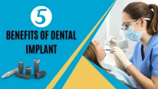 5 Benefits of Dental Implant