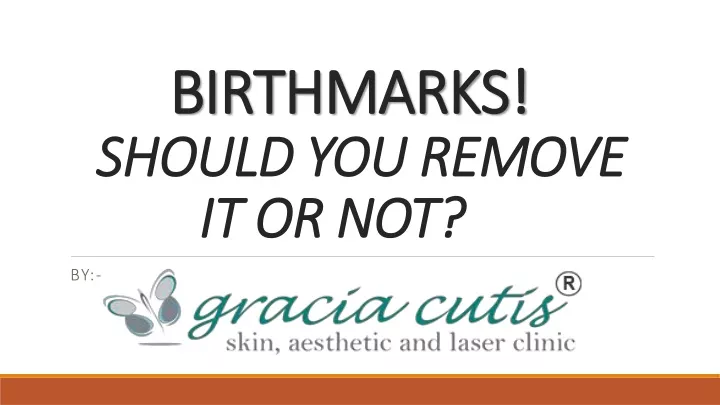 birthmarks should you remove it or not