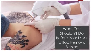 what you shouldn t do before your laser tattoo removal session