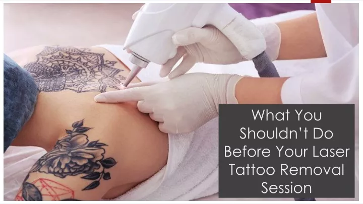 what you shouldn t do before your laser tattoo removal session
