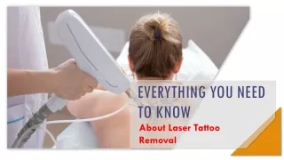 Things You Need To Know About Laser Tattoo Removal