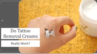 Everything about Tattoo Removal Creams And How it Works?