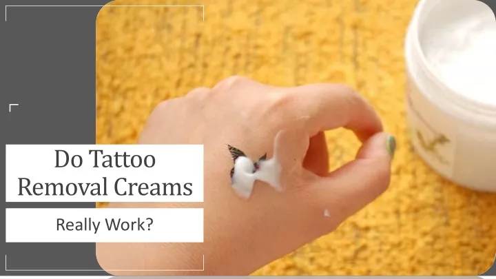 do tattoo removal creams