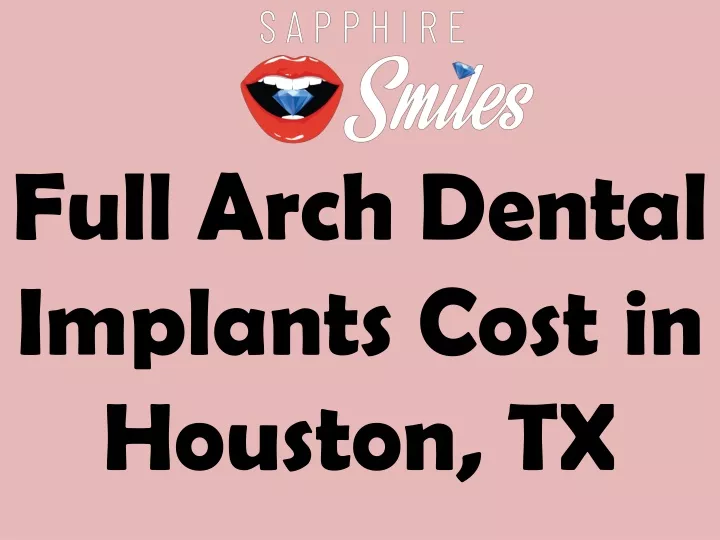 full arch dental implants cost in houston tx