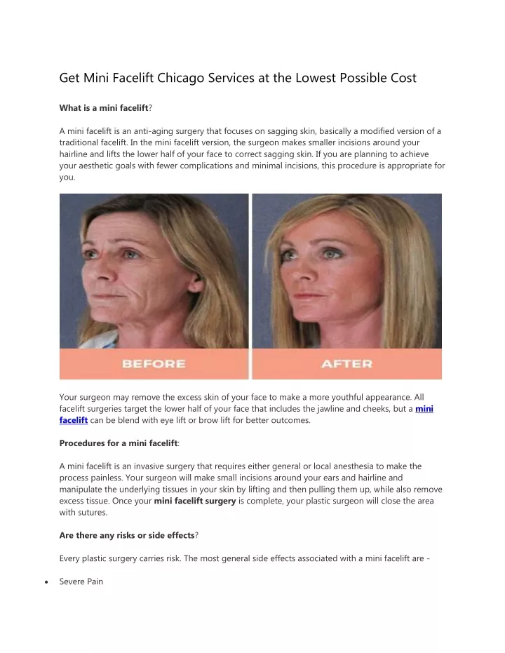 get mini facelift chicago services at the lowest