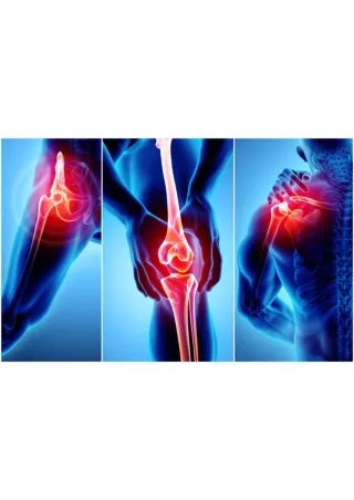 Dr. Sachin Chhabra – Joint Replacement Surgeon In Indore