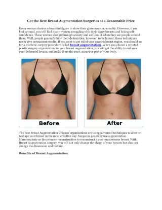 get the best breast augmentation surgeries