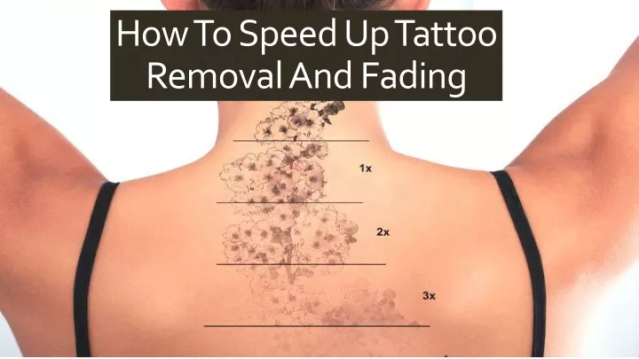 how to speed up tattoo removal and fading