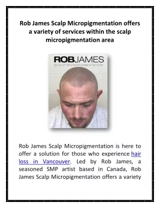 rob james scalp micropigmentation offers