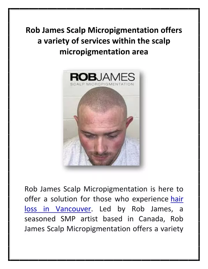 rob james scalp micropigmentation offers
