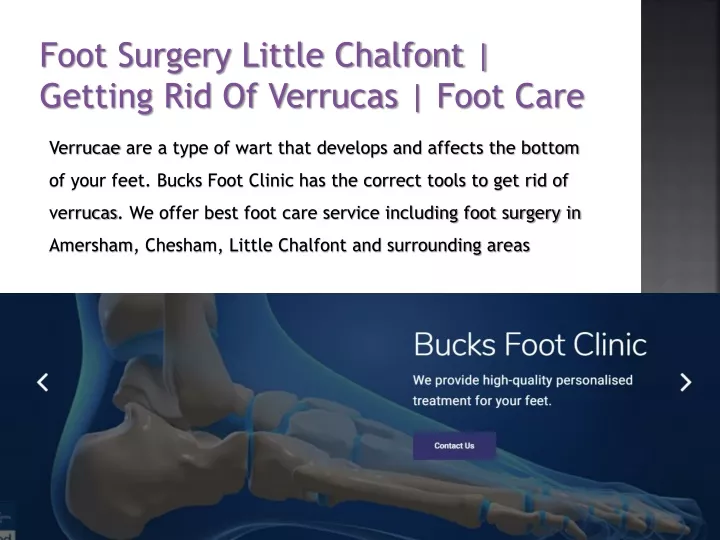 foot surgery little chalfont getting rid of verrucas foot care