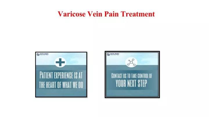 varicose vein pain treatment