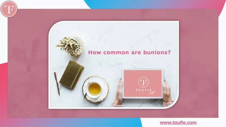 how common are bunions