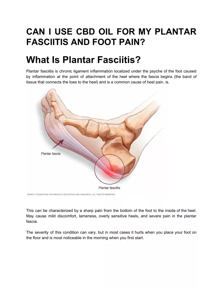 can i use cbd oil for my plantar fasciitis