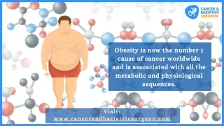 Obesity and Cancer | Best Onco-Surgeon in Bangalore