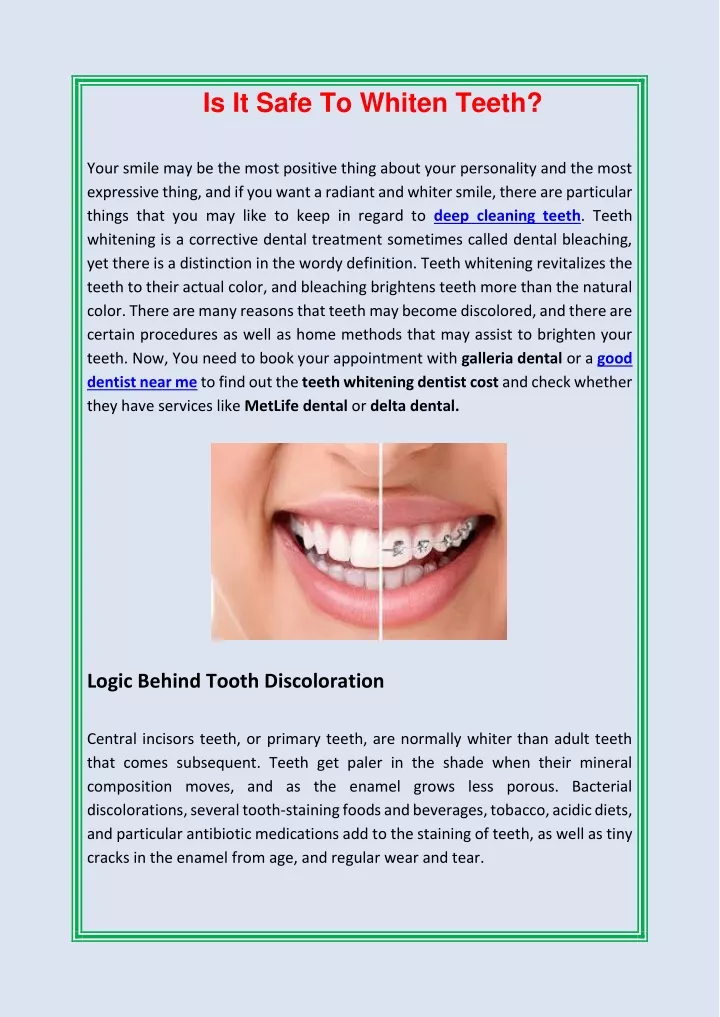 is it safe to whiten teeth