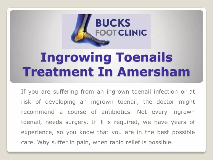 ingrowing toenails treatment in amersham