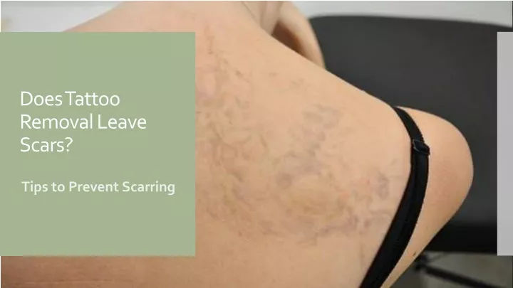 does tattoo removal leave scars