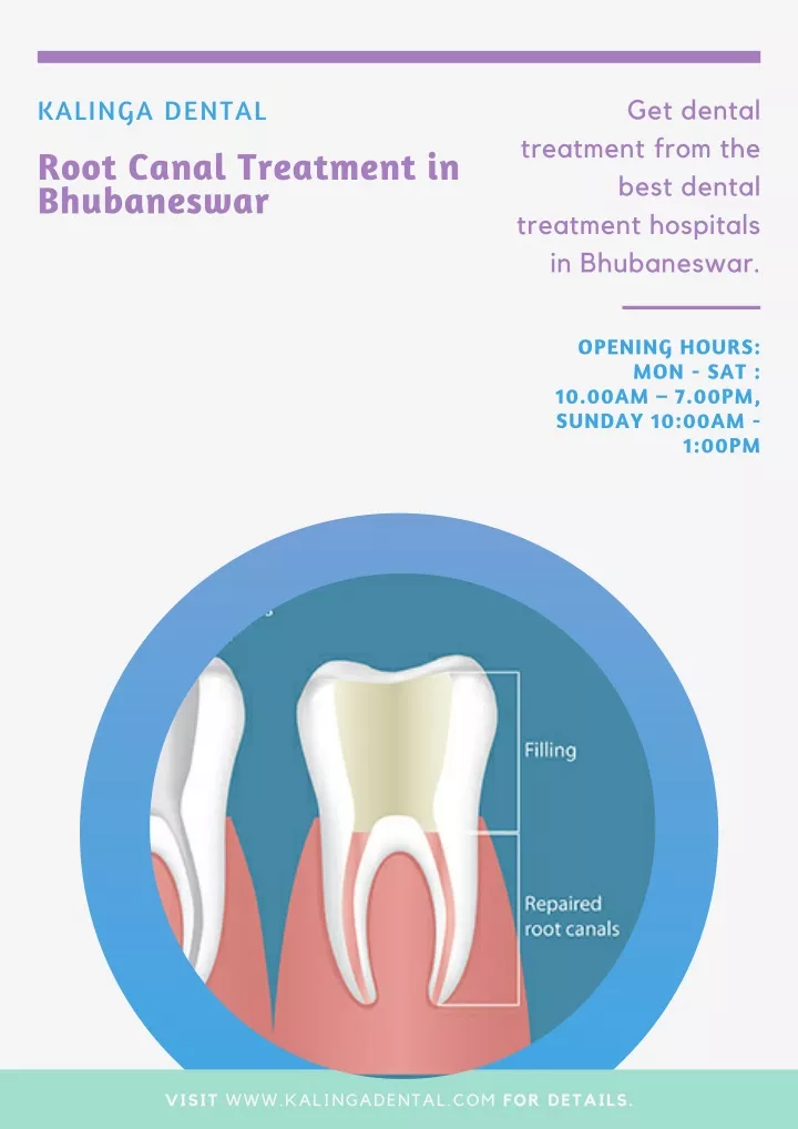 kalinga dental root canal treatment in bhubaneswar