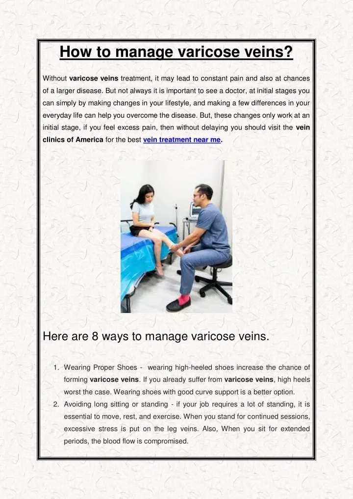 how to manage varicose veins