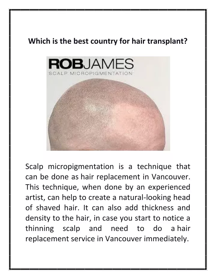 which is the best country for hair transplant