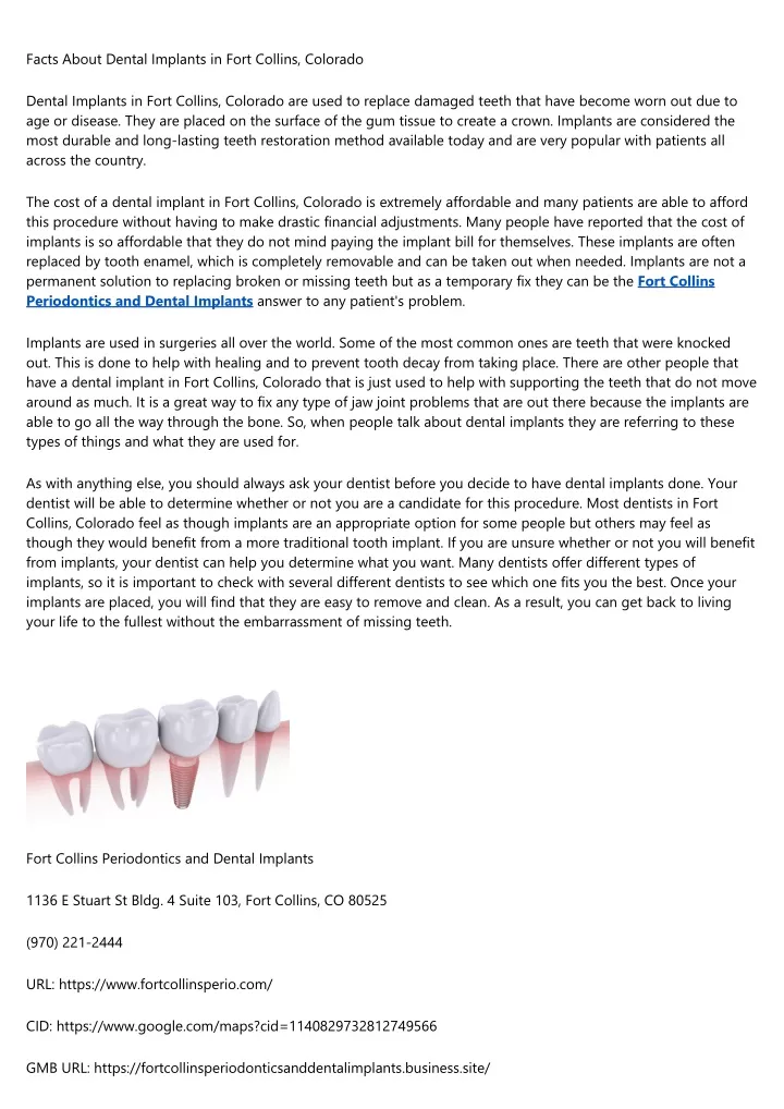 facts about dental implants in fort collins