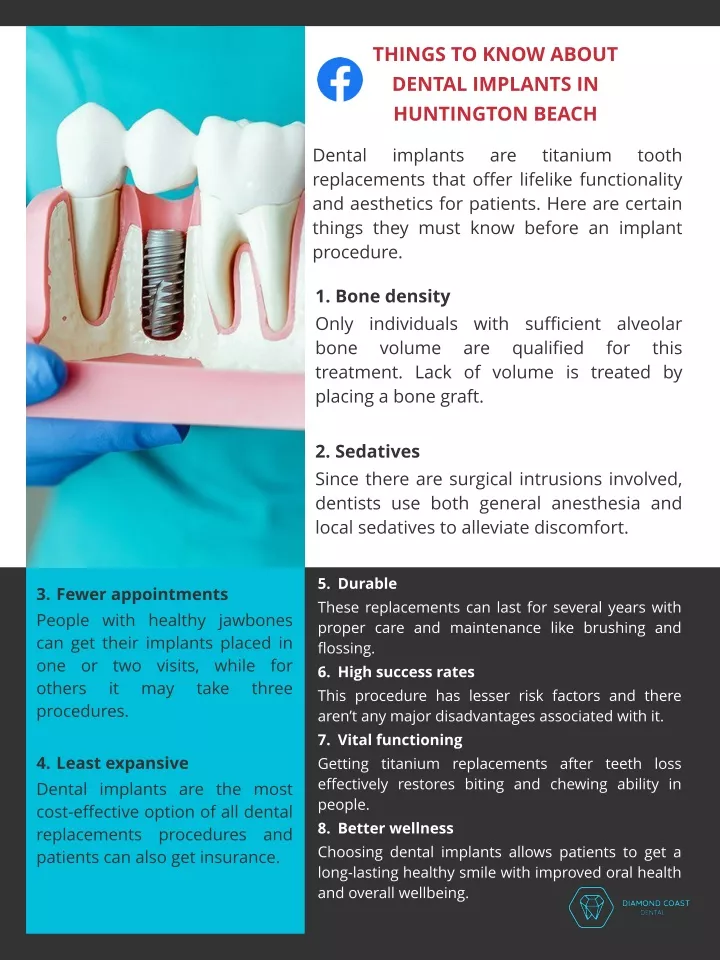 things to know about dental implants