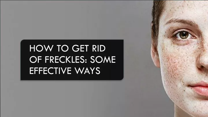 how to get rid of freckles some effective ways