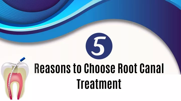 reasons to choose root canal treatment