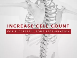 Increased Cell Count for Successful Bone Regeneration
