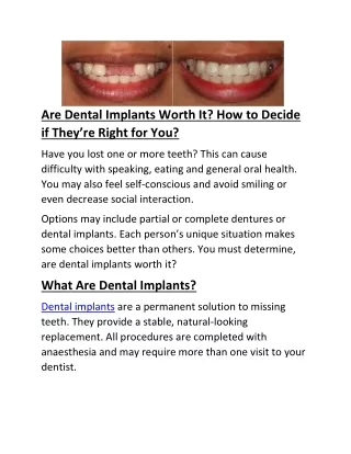 Are Dental Implants Worth It? How to Decide if They’re Right for You?