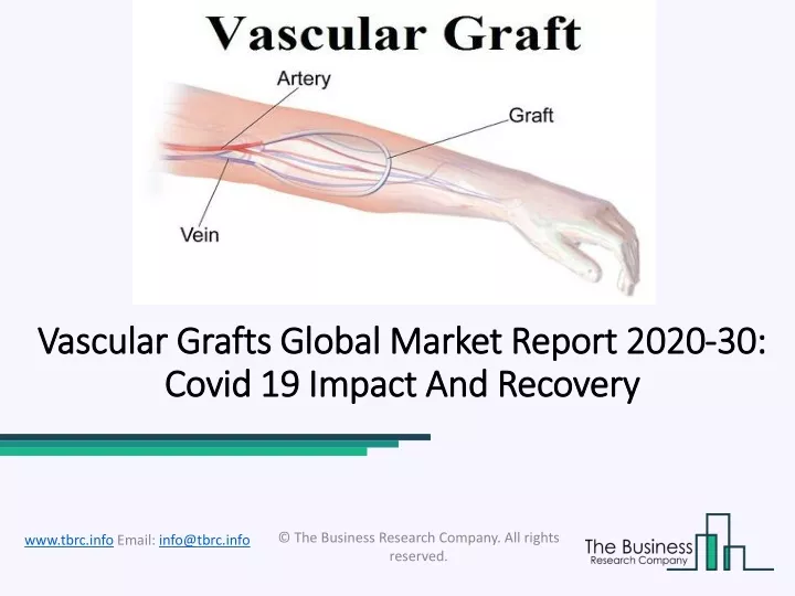 vascular vascular grafts global grafts global