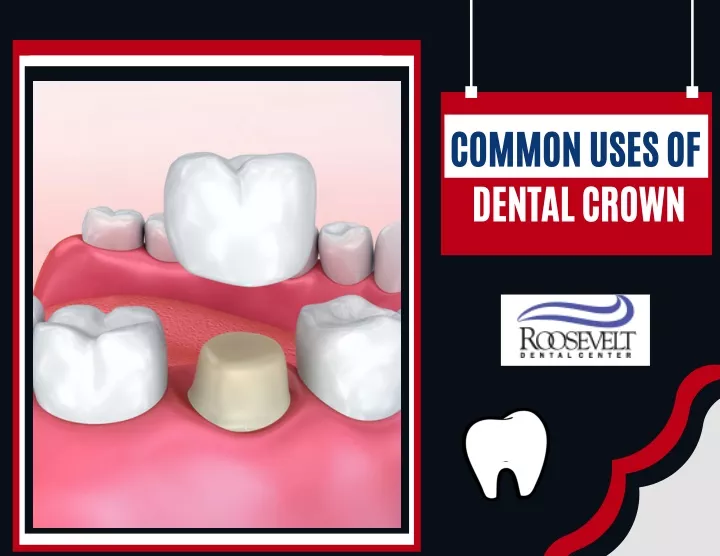 common uses of dental crown