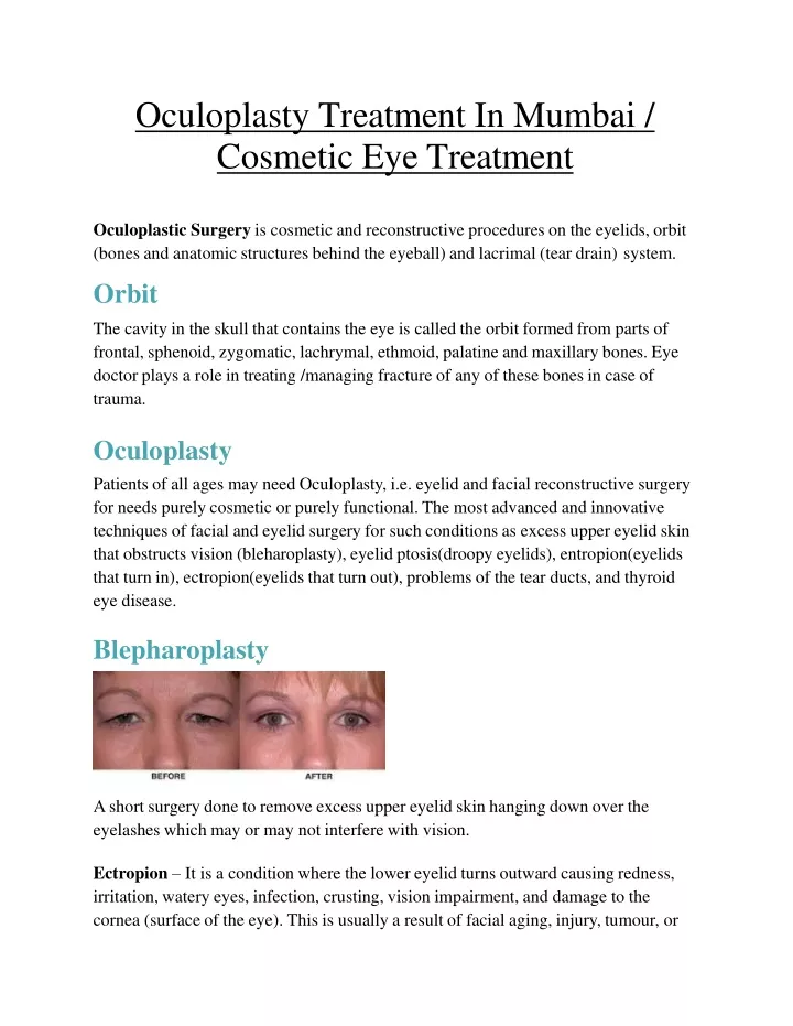 oculoplasty treatment in mumbai cosmetic eye treatment