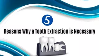 5 Reasons Why a Tooth Extraction is Necessary