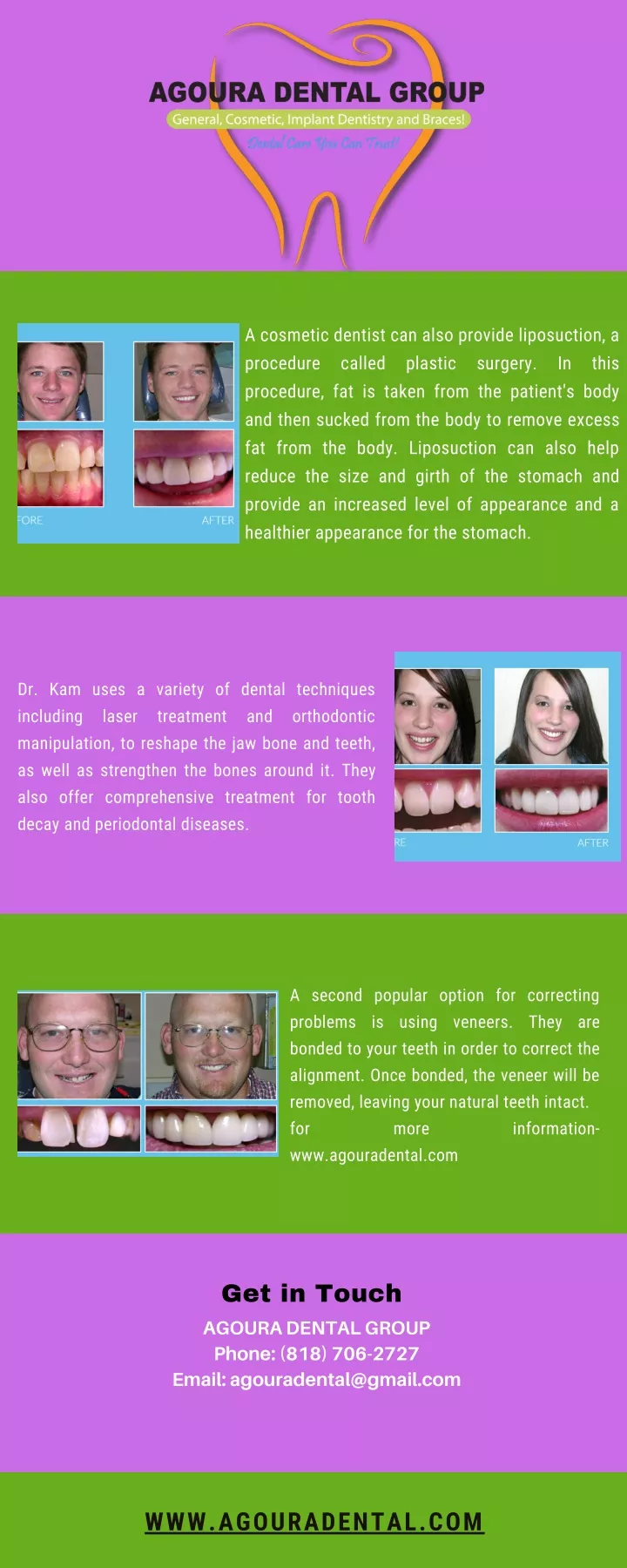 a cosmetic dentist can also provide liposuction